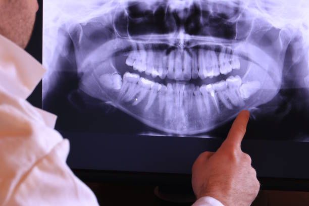 Best Emergency Dental Extractions in Powderly, TX