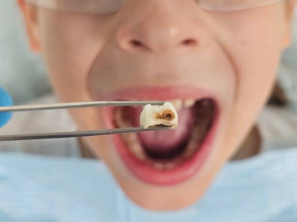 Best Mobile Emergency Dentist in Powderly, TX